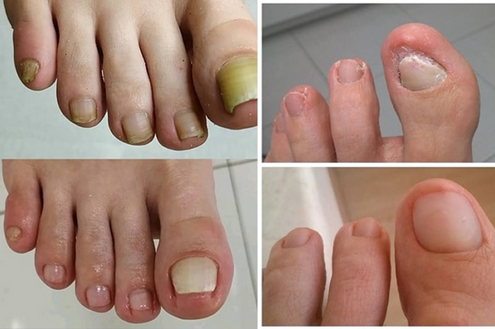 Результаты лечения