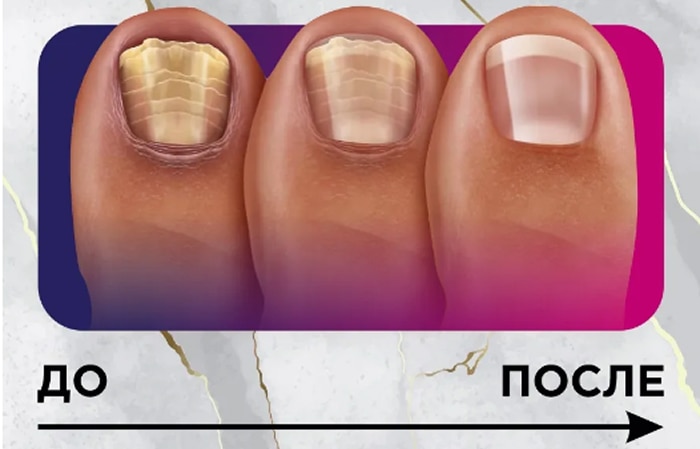 Восстановление